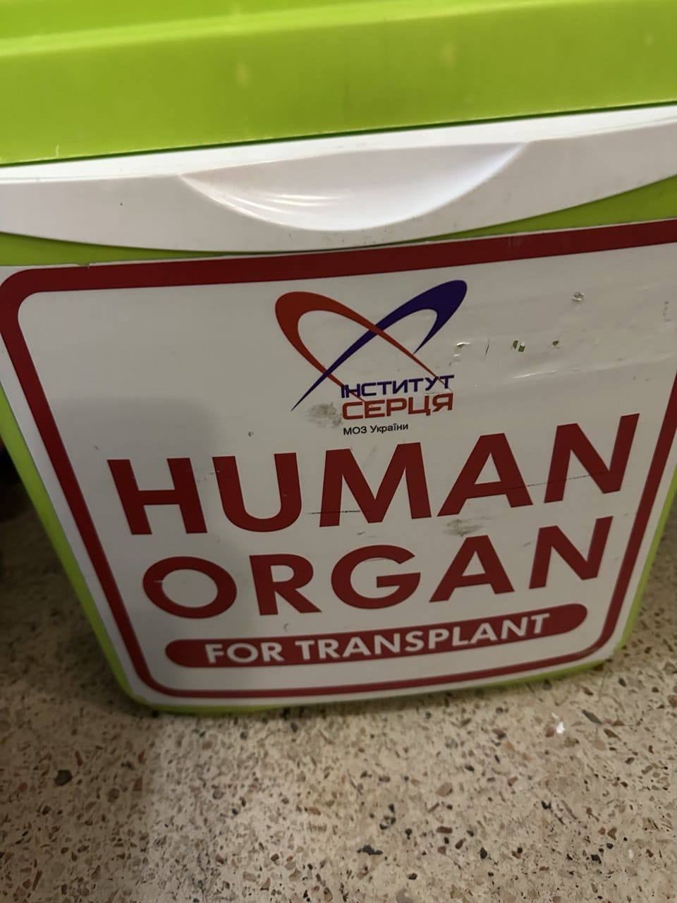 В Одесі провели одразу кілька трансплантацій: врятували трьох пацієнтів